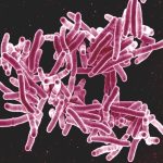 Study identifies potential novel drug to treat tuberculosis