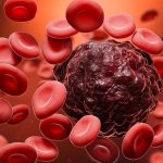 Scientists identify drug-resistant bone marrow cells linked to poor outcomes in fast-growing leukemia