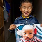 ‘Perfect partnership’: New tech allows Smile Train to expand global cleft care with Dentsply Sirona